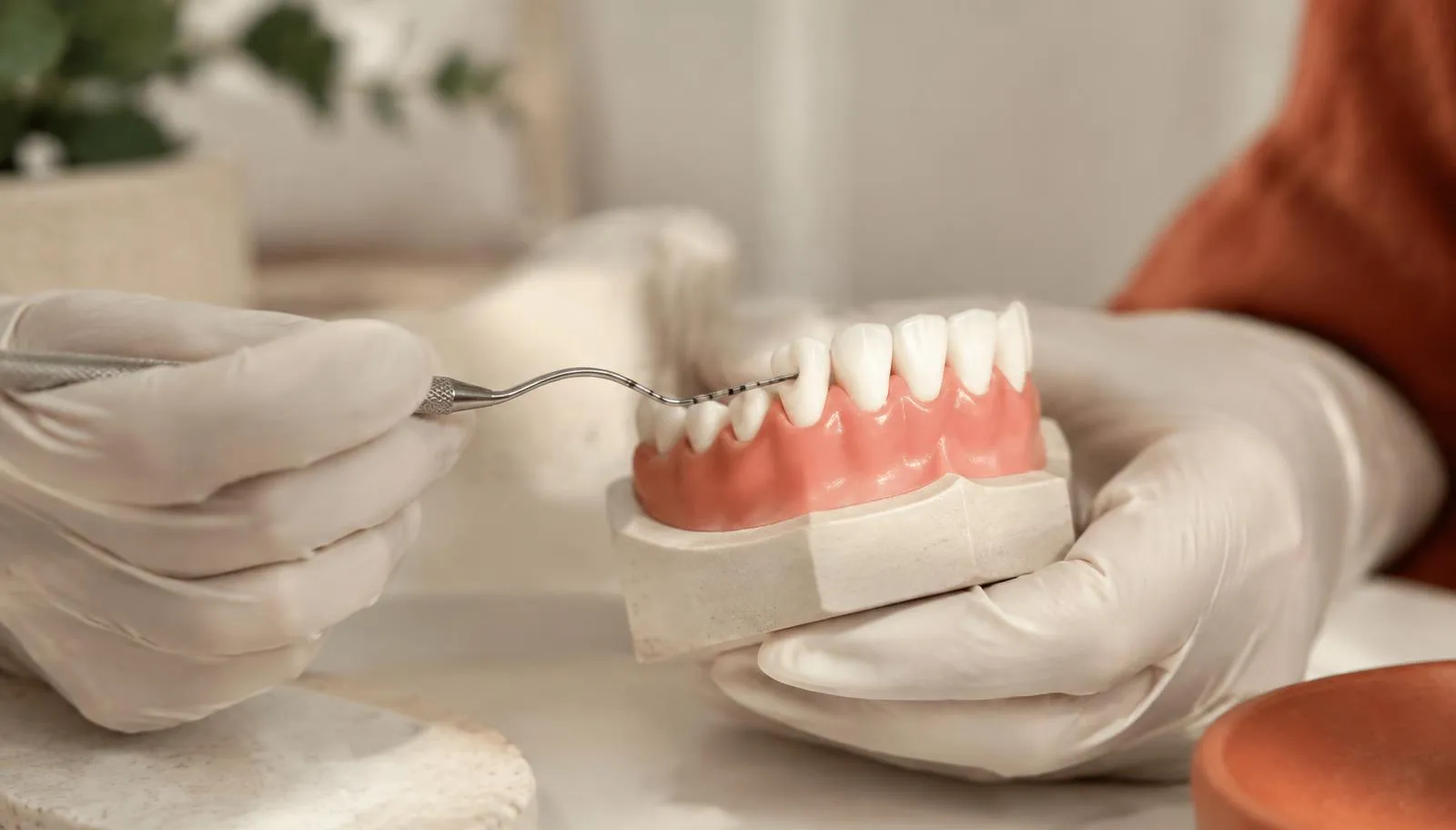 Sonde parodontale mesurant la gencive sur un modèle dentaire